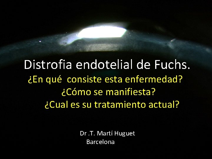 Distrofia endotelial de Fuchs. ¿En qué consiste esta enfermedad? ¿Cómo se manifiesta? ¿Cual es