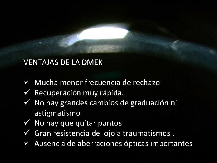 VENTAJAS DE LA DMEK ü Mucha menor frecuencia de rechazo ü Recuperación muy rápida.