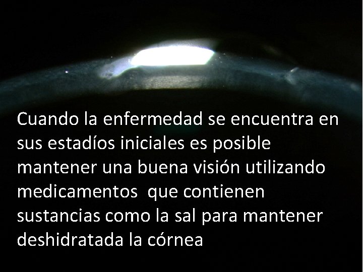 Cuando la enfermedad se encuentra en sus estadíos iniciales es posible mantener una buena