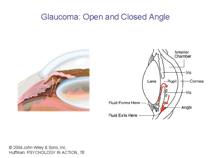 Glaucoma: Open and Closed Angle © 2004 John Wiley & Sons, Inc. Huffman: PSYCHOLOGY