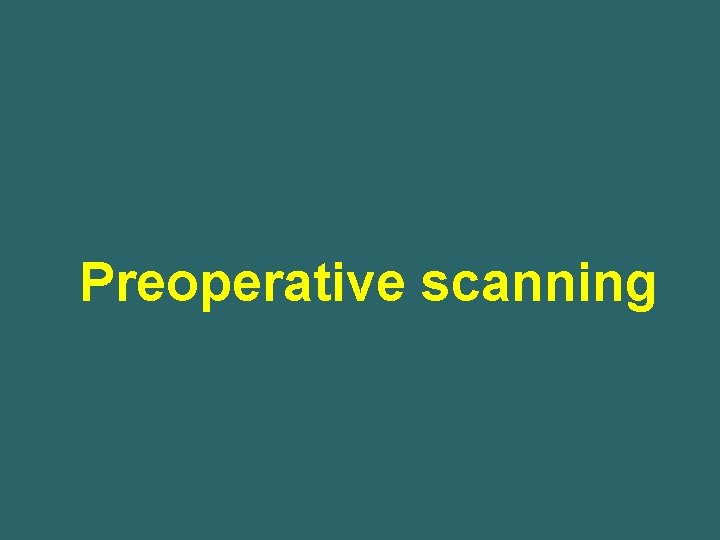 Preoperative scanning 