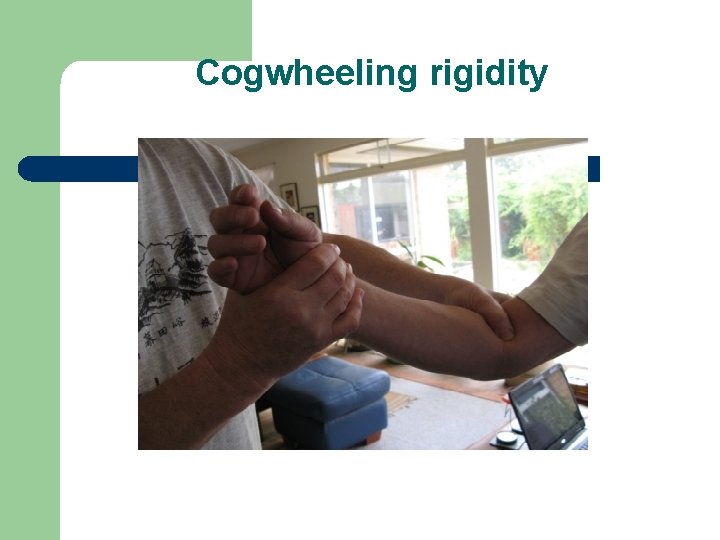 Cogwheeling rigidity 