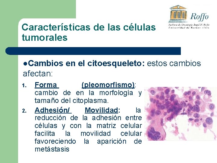 Características de las células tumorales l. Cambios en el citoesqueleto: estos cambios afectan: 1.