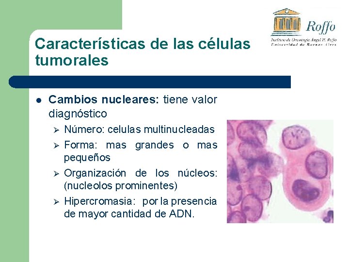 Características de las células tumorales l Cambios nucleares: tiene valor diagnóstico Ø Ø Número: