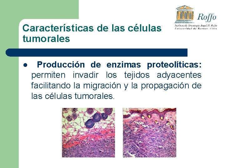 Características de las células tumorales l Producción de enzimas proteolíticas: permiten invadir los tejidos