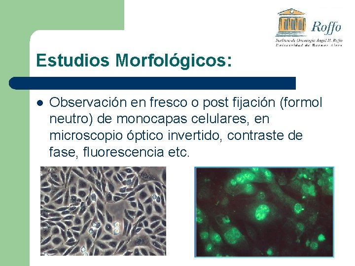 Estudios Morfológicos: l Observación en fresco o post fijación (formol neutro) de monocapas celulares,