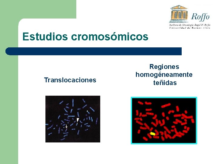 Estudios cromosómicos Translocaciones Regiones homogéneamente teñidas 