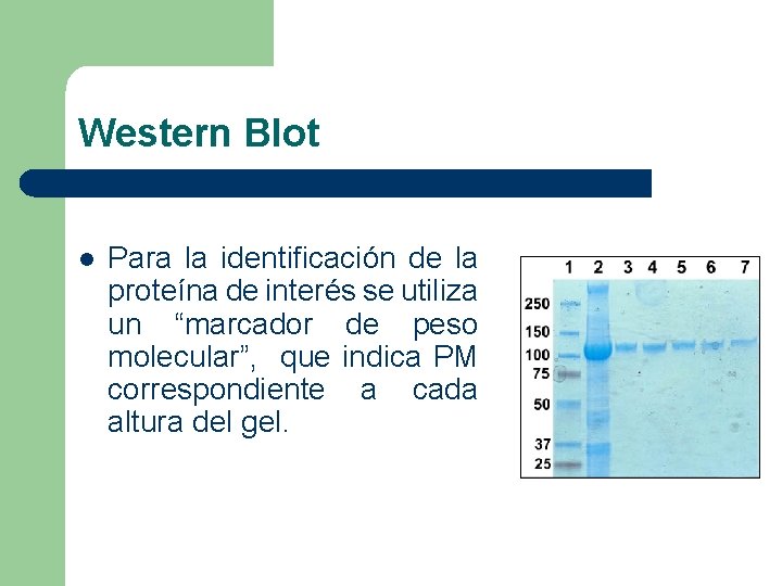 Western Blot l Para la identificación de la proteína de interés se utiliza un