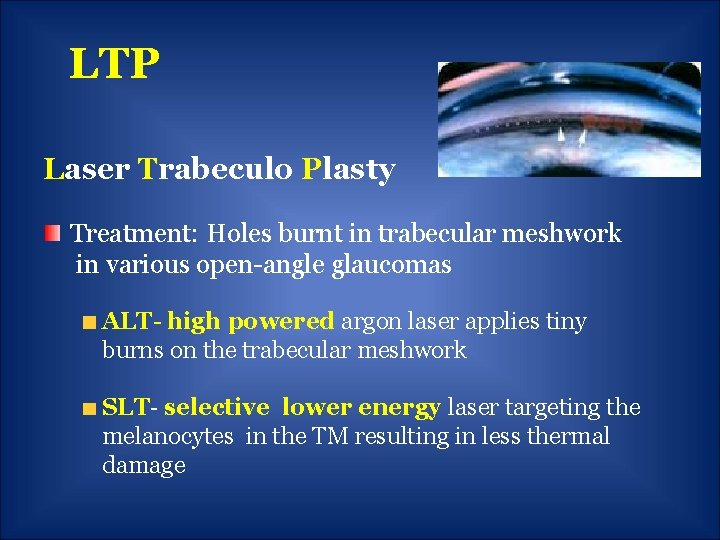 LTP Laser Trabeculo Plasty Treatment: Holes burnt in trabecular meshwork in various open-angle glaucomas