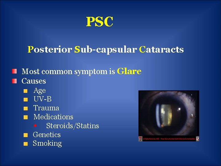 PSC Posterior Sub-capsular Cataracts Most common symptom is Glare Causes Age UV-B Trauma Medications