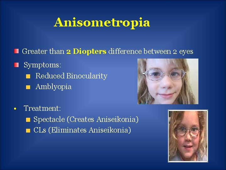 Anisometropia Greater than 2 Diopters difference between 2 eyes Symptoms: Reduced Binocularity Amblyopia •