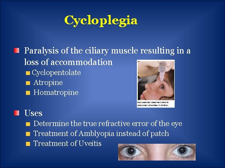 Cycloplegia Paralysis of the ciliary muscle resulting in a loss of accommodation Cyclopentolate Atropine