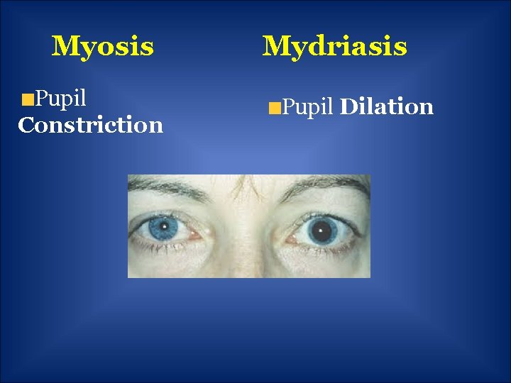 Myosis Pupil Constriction Mydriasis Pupil Dilation 
