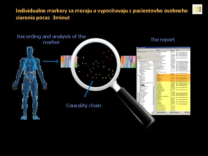 Individualne markery sa meraju a vypocitavaju z pacientovho osobneho ziarenia pocas 3 minut Recording