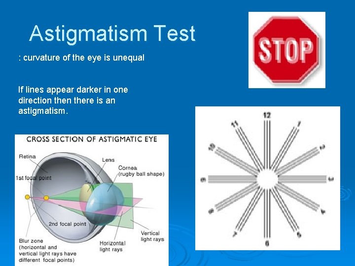 Astigmatism Test : curvature of the eye is unequal If lines appear darker in