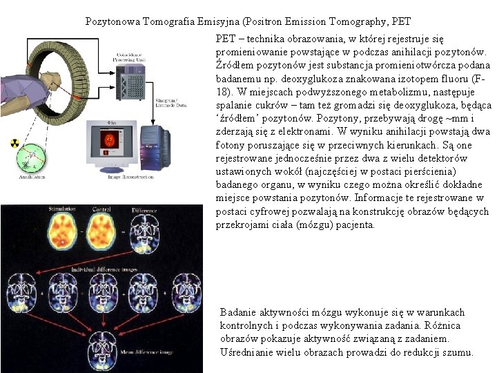 Pozytonowa Tomografia Emisyjna (Positron Emission Tomography, PET – technika obrazowania, w której rejestruje się