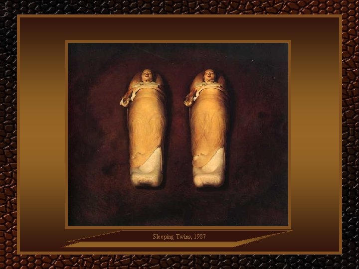 Sleeping Twins, 1987 