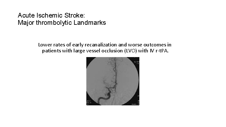 Acute Ischemic Stroke: Major thrombolytic Landmarks Lower rates of early recanalization and worse outcomes