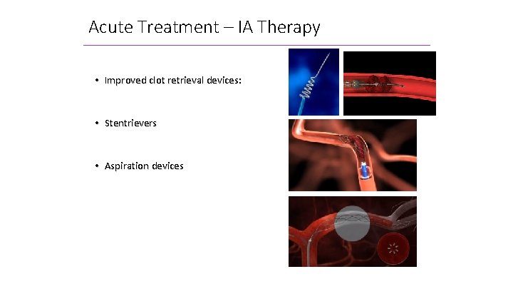 Acute Treatment – IA Therapy • Improved clot retrieval devices: • Stentrievers • Aspiration