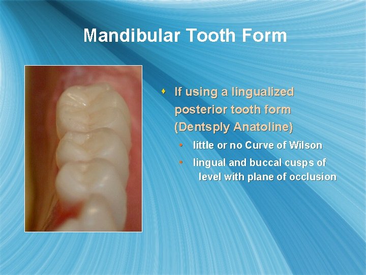 Mandibular Tooth Form s If using a lingualized posterior tooth form (Dentsply Anatoline) •