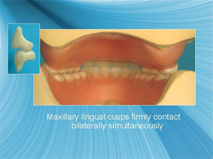 Maxillary lingual cusps firmly contact bilaterally simultaneously 