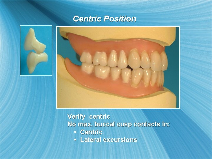 Centric Position Verify centric No max. buccal cusp contacts in: • Centric • Lateral