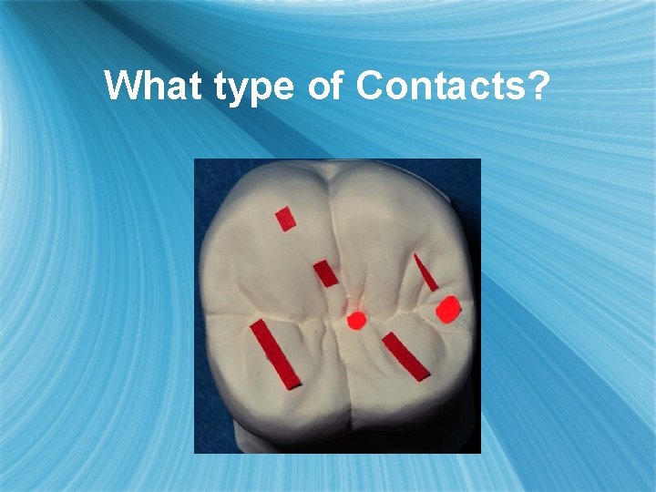 What type of Contacts? 