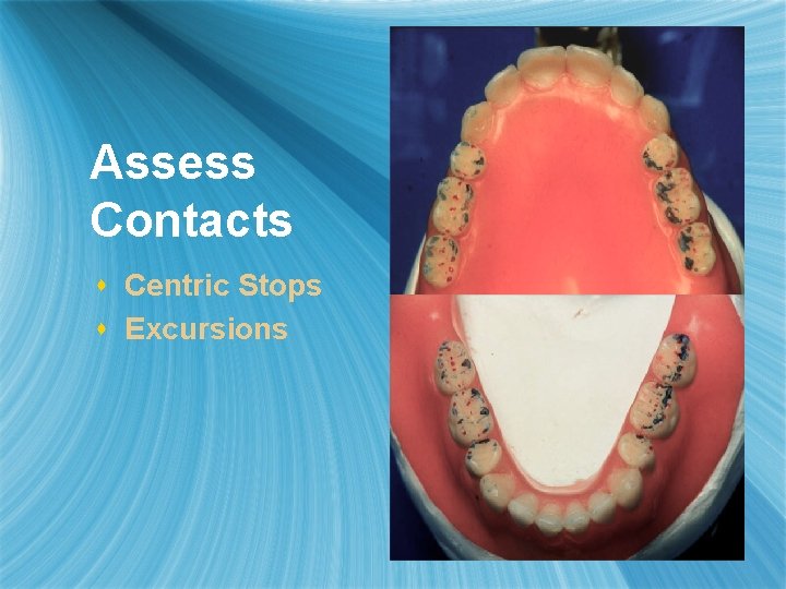 Assess Contacts s Centric Stops s Excursions 