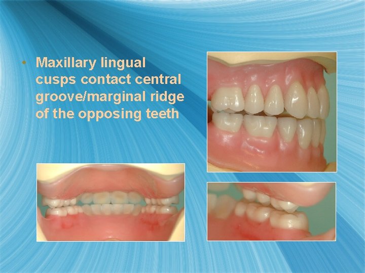  • Maxillary lingual cusps contact central groove/marginal ridge of the opposing teeth 