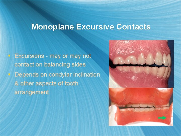 Monoplane Excursive Contacts s Excursions - may or may not contact on balancing sides