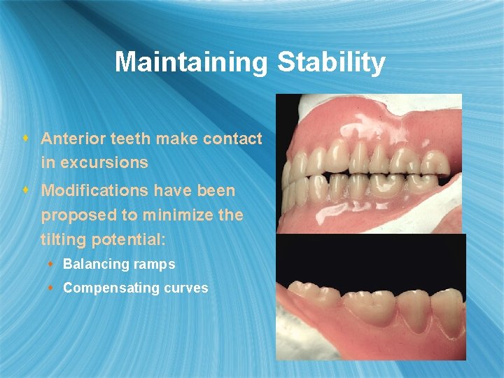 Maintaining Stability s Anterior teeth make contact in excursions s Modifications have been proposed