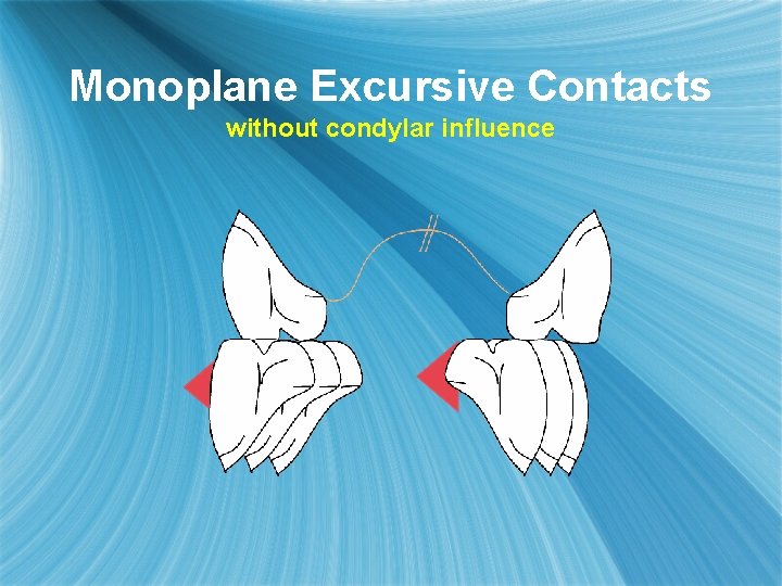 Monoplane Excursive Contacts without condylar influence 