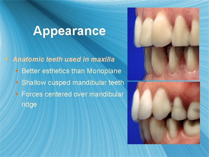 Appearance s Anatomic teeth used in maxilla s Better esthetics than Monoplane s Shallow