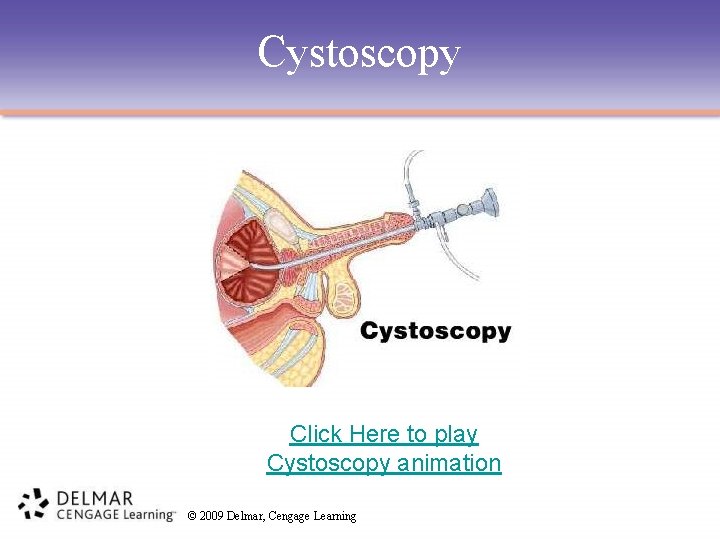 Cystoscopy Click Here to play Cystoscopy animation © 2009 Delmar, Cengage Learning 