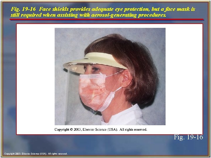 Fig. 19 -16 Face shields provides adequate eye protection, but a face mask is