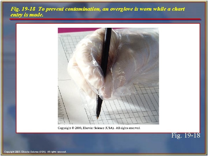 Fig. 19 -18 To prevent contamination, an overglove is worn while a chart entry