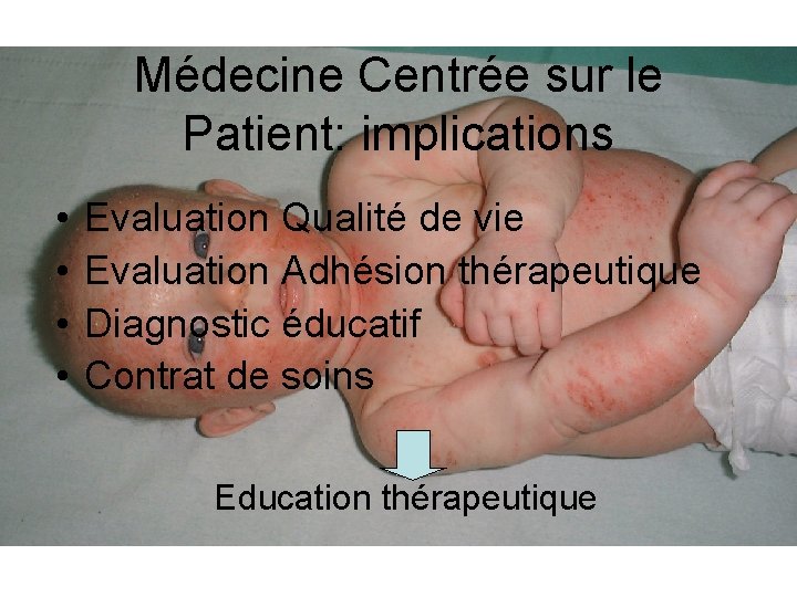 Médecine Centrée sur le Patient: implications • • Evaluation Qualité de vie Evaluation Adhésion