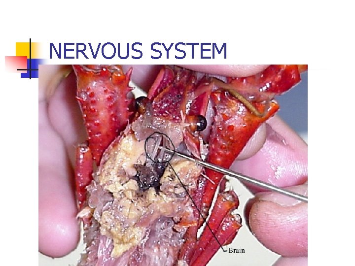 NERVOUS SYSTEM 