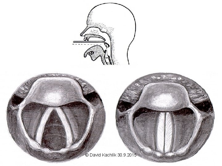 © David Kachlík 30. 9. 2015 