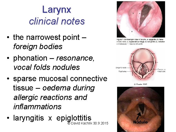 Larynx clinical notes • the narrowest point – foreign bodies • phonation – resonance,