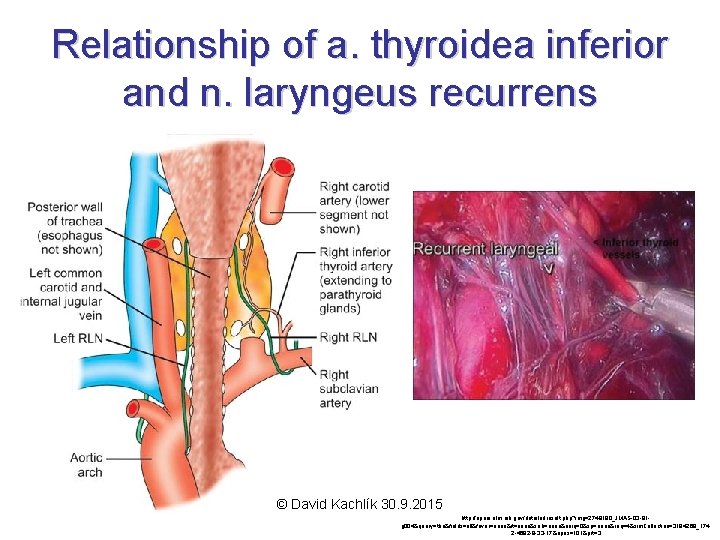 Relationship of a. thyroidea inferior and n. laryngeus recurrens © David Kachlík 30. 9.