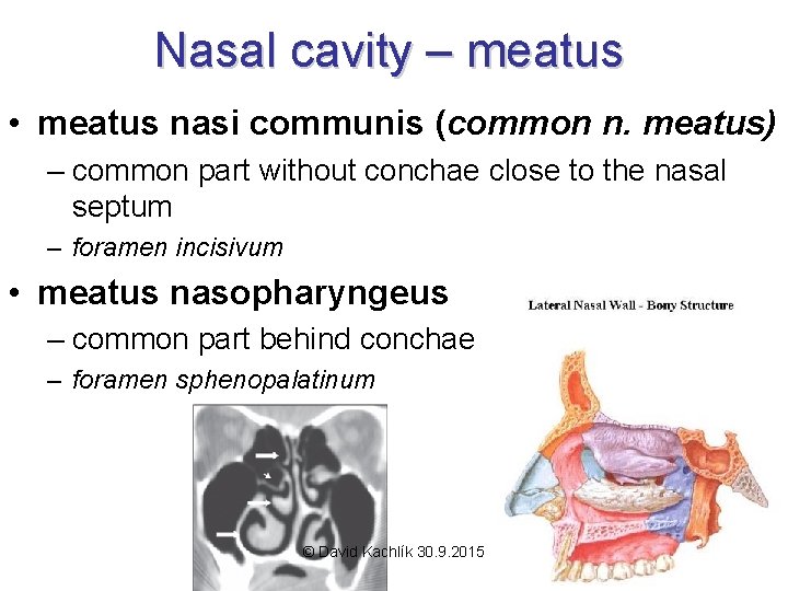 Nasal cavity – meatus • meatus nasi communis (common n. meatus) – common part