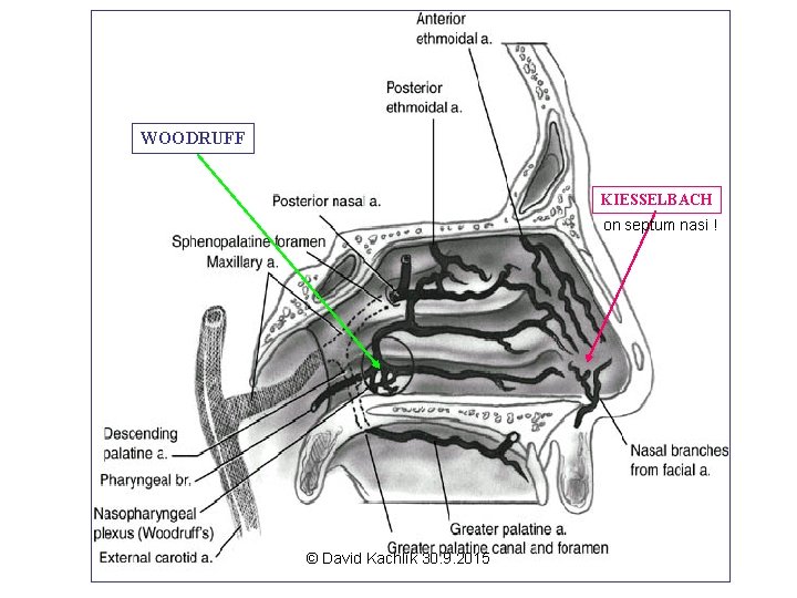WOODRUFF KIESSELBACH on septum nasi ! © David Kachlík 30. 9. 2015 