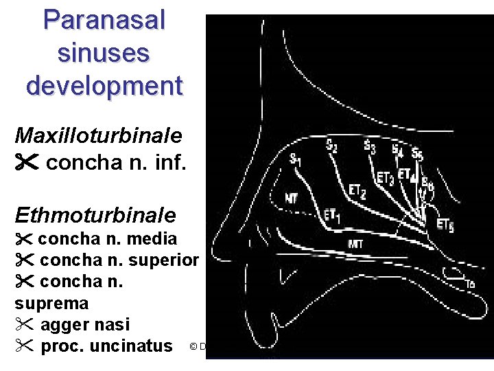 Paranasal sinuses development Maxilloturbinale concha n. inf. Ethmoturbinale concha n. media concha n. superior