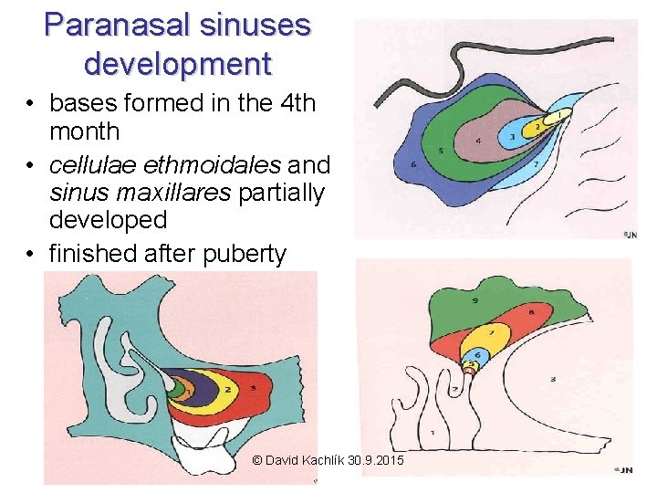 Paranasal sinuses development • bases formed in the 4 th month • cellulae ethmoidales