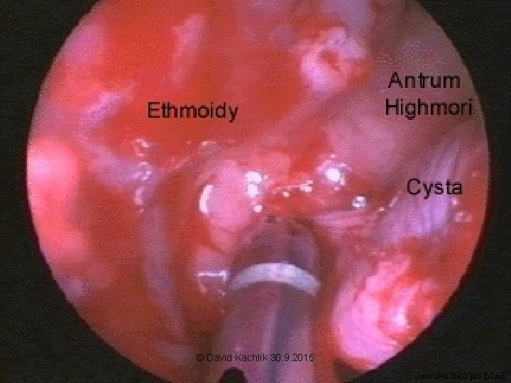 © David Kachlík 30. 9. 2015 Janoušek 2008 pro ECAE 