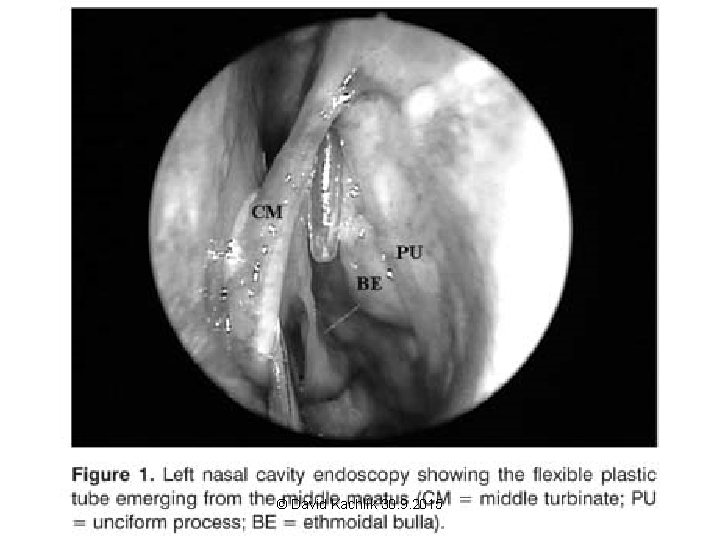 © David Kachlík 30. 9. 2015 