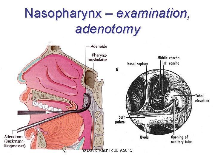 Nasopharynx – examination, adenotomy © David Kachlík 30. 9. 2015 