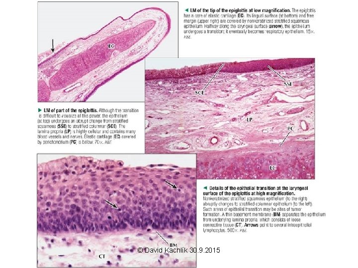 © David Kachlík 30. 9. 2015 