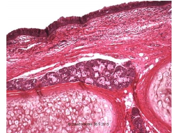 © David Kachlík 30. 9. 2015 